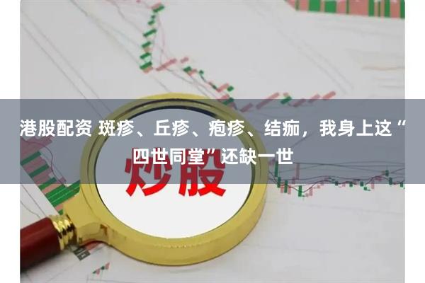 港股配资 斑疹、丘疹、疱疹、结痂，我身上这“四世同堂”还缺一世